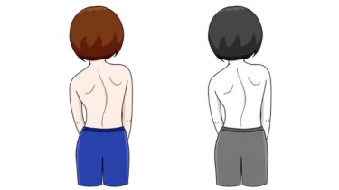 内科検診 ～背骨のゆがみ(上半身～ズボン)～ のイラスト（カラー・モノクロ）