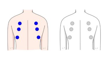 内科検診 ～聴診器を当てるところ（背面）～ のイラスト（カラー・モノクロ）